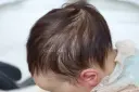 Micro Rooting