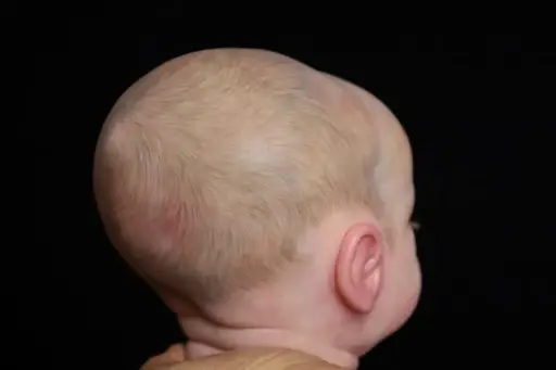 Pelo Pintado
